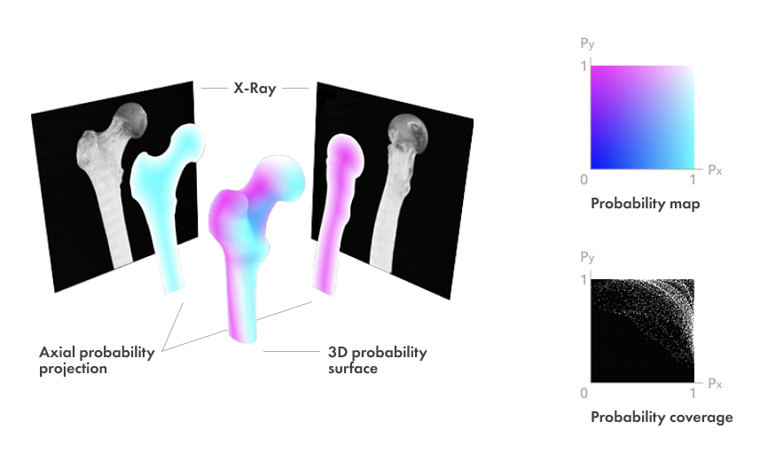 New Machine Learning Algorithm Elevates XRay Imaging to the Next Level