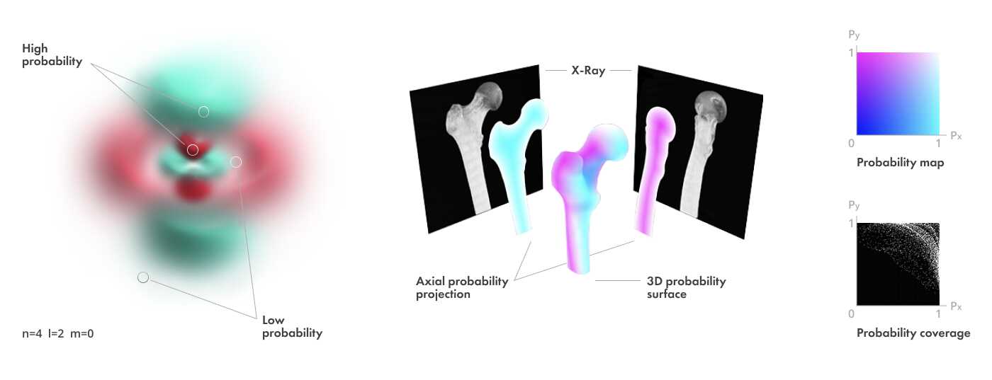 X-ray Stereogrammetry (RSA) Powered by Machine Learning as an Alternative to CT